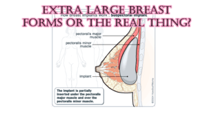 breast forms